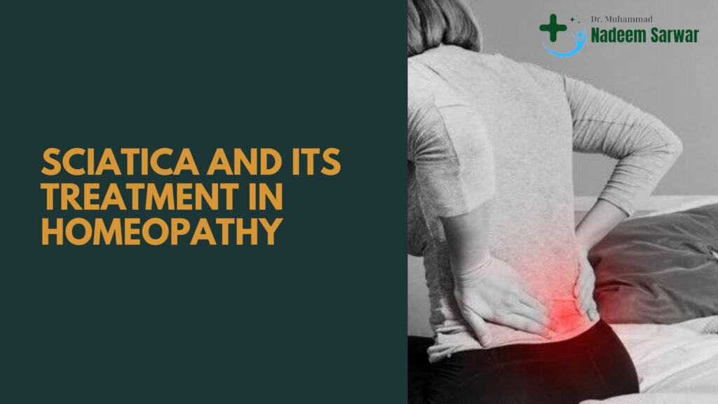 What is Sciatica: Its Treatment in Homeopathy