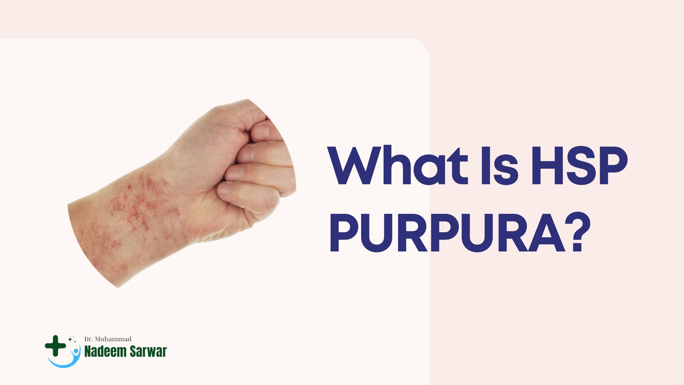What Is HSP PURPURA? HSP PURPURA Treatment in Homoeopathy